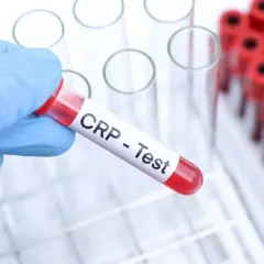 Ręka w niebieskiej rękawiczce trzyma probówkę z napisem "CRP - Test". W tle widać stojak z innymi probówkami. Cena badania CRP jest kluczowa dla oceny stanu zapalnego.