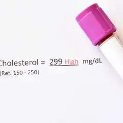 Wynik cholesterolu 299 mg/dL (wysoki). Może być potrzebny ezetymib. Obok probówka z fioletową zakrętką.