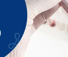 Jaki wynik FSH świadczy o menopauzie i co to oznacza dla zdrowia?