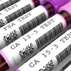 Rurki z próbkami krwi do badań: CEA marker, PSA, CA 12-5, CA 15-3.