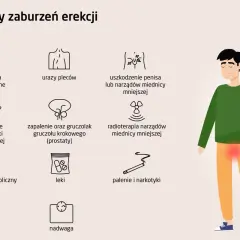 Ilustracja przedstawia przyczyny impotencji: problemy neurologiczne, urazy, uszkodzenia, zaburzenia hormonalne, choroby prostaty, radioterapię, zespół metaboliczny, leki, nadwagę, palenie i narkotyki.
