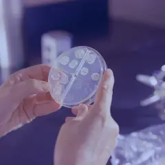 Dłonie trzymają szalkę Petriego z koloniami bakterii, prawdopodobnie Proteus mirabilis, widoczne są podziały na cztery sekcje.