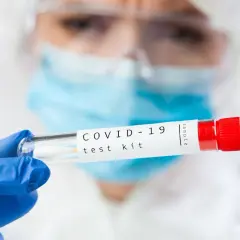 Osoba w kombinezonie ochronnym trzyma probówkę z wymazem. Zastanawiasz się, ile kosztuje test na COVID-19?