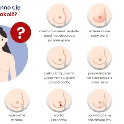 Grafika pokazuje objawy, które mogą świadczyć o zapaleniu piersi: zmiany wielkości, koloru, wciąganie skóry, guzki, wyciek z brodawki, ból.