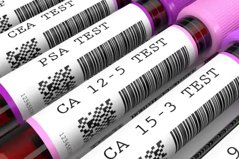 Rurki z próbkami krwi do badań: CEA marker, PSA, CA 12-5, CA 15-3.