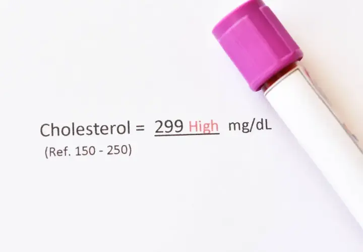 Wynik cholesterolu 299 mg/dL (wysoki). Może być potrzebny ezetymib. Obok probówka z fioletową zakrętką.