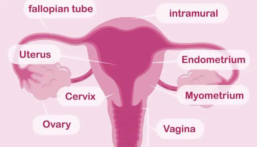 Schemat kobiecych narządów rozrodczych: jajniki, jajowody, macica z endometrium i mięśniówką, szyjka macicy i pochwa.