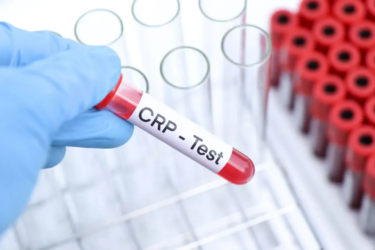 Ręka w niebieskiej rękawiczce trzyma probówkę z napisem "CRP - Test". W tle widać stojak z innymi probówkami. Cena badania CRP jest kluczowa dla oceny stanu zapalnego.