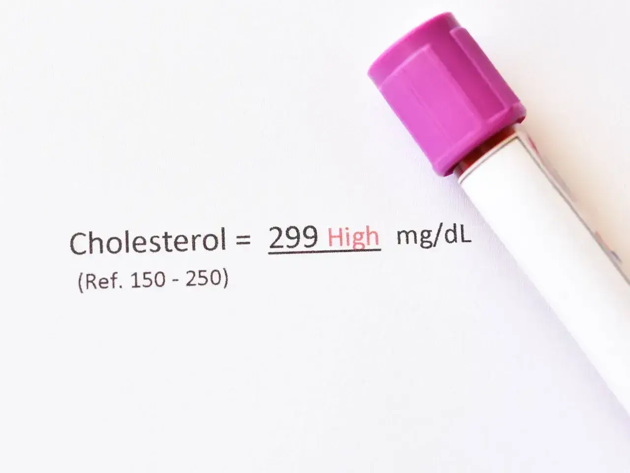 Wynik cholesterolu 299 mg/dL (wysoki). Może być potrzebny ezetymib. Obok probówka z fioletową zakrętką.