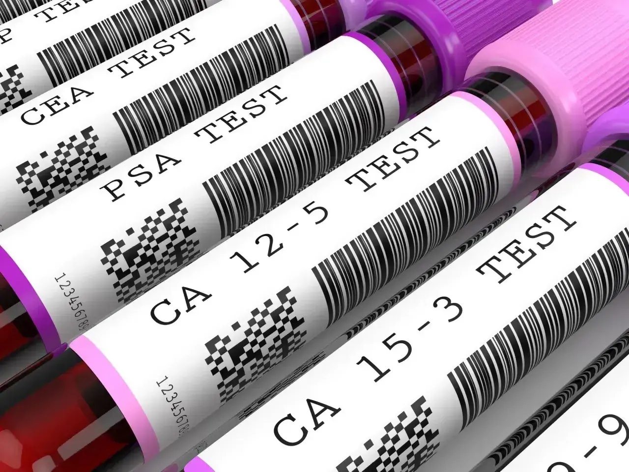 Rurki z próbkami krwi do badań: CEA marker, PSA, CA 12-5, CA 15-3.
