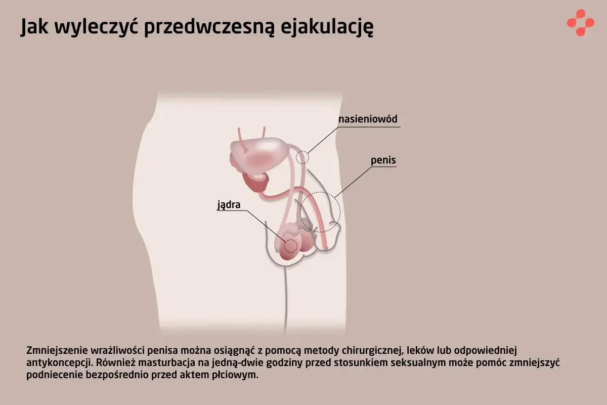 Ilustracja układu rozrodczego męskiego z opisami: jądra, nasieniowód, penis. Tekst omawia metody leczenia przedwczesnego wytrysku.
