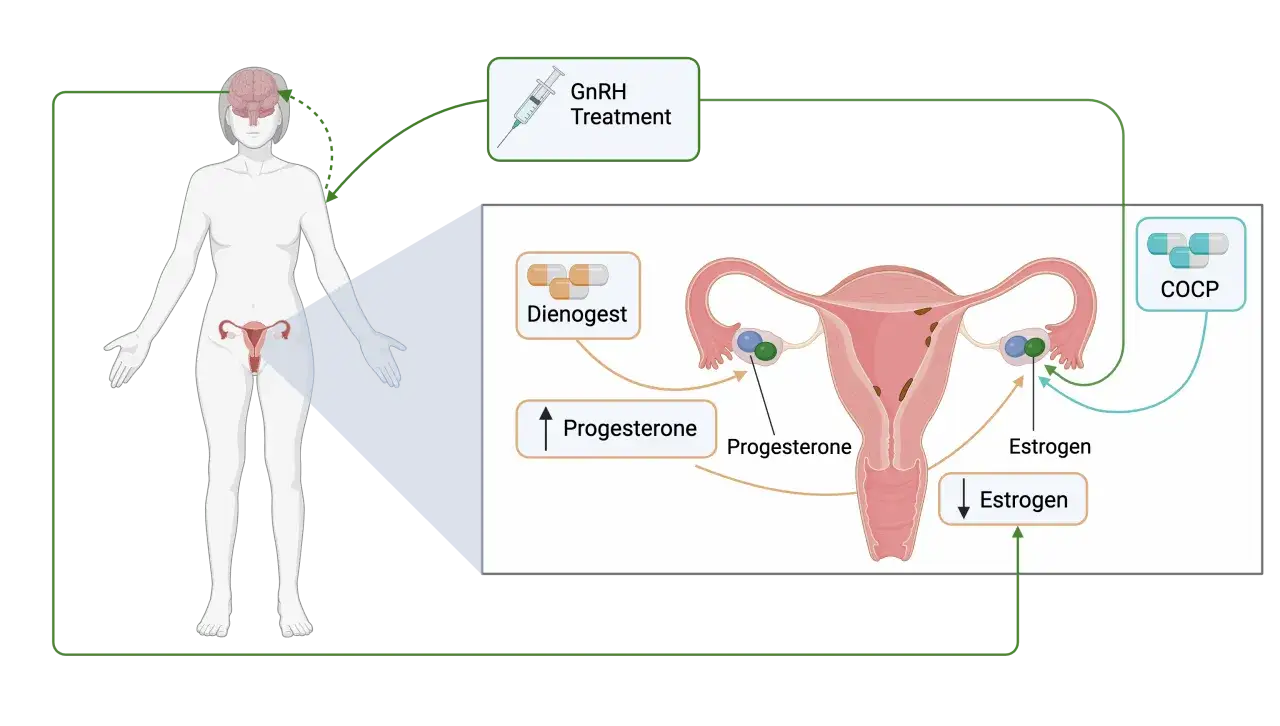 Schemat przedstawia wpływ Dienogestu i COCP na cykl hormonalny, leczenie endovelle.