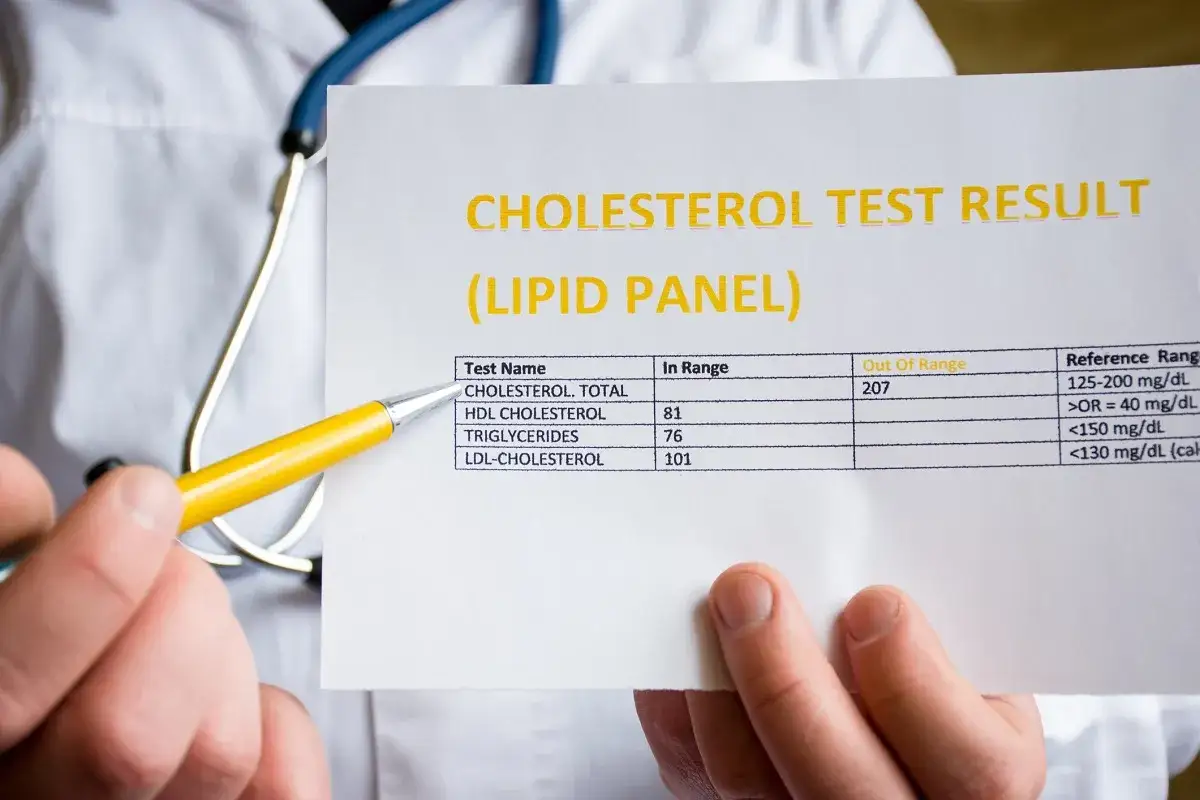 Lekarz wskazuje na wynik lipidogramu, gdzie cholesterol całkowity jest podwyższony. Może to sugerować potrzebę leczenia, np. ezetymibem.