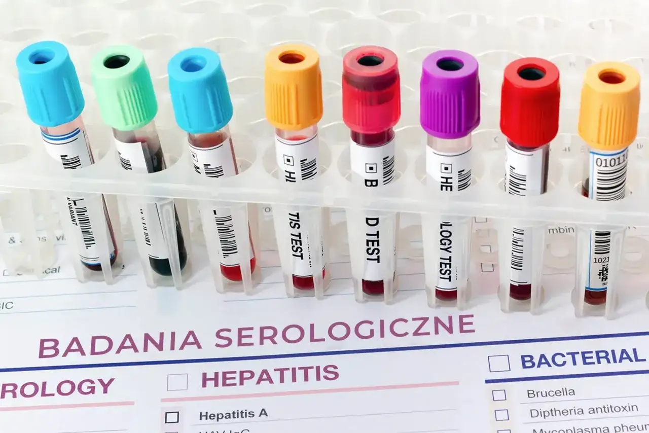 Próbówki z kolorowymi nakrętkami, gotowe do badań serologicznych, w tym na ige całkowite.